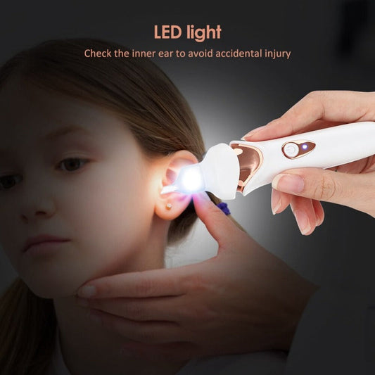 Aspirador de cerumen sin dolor