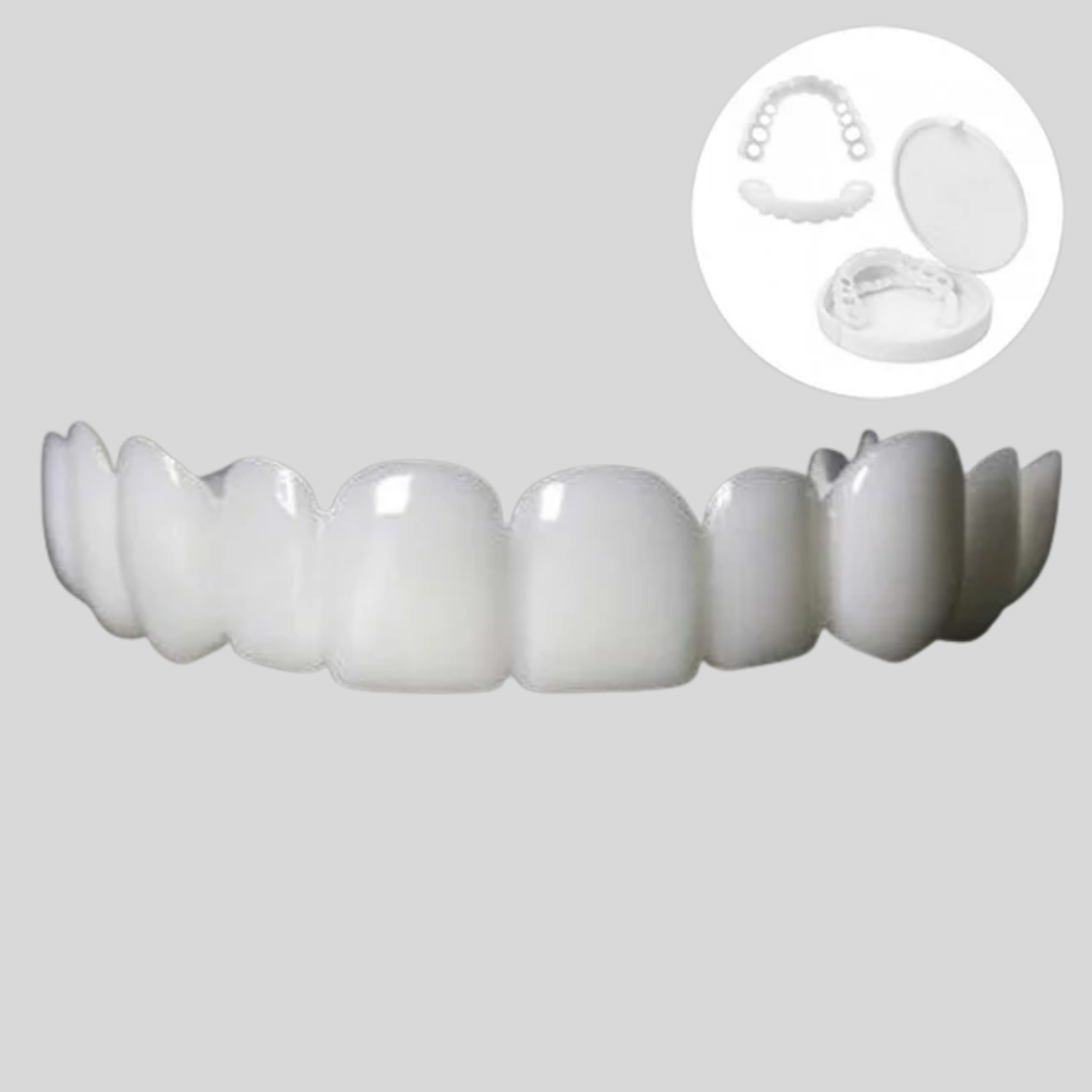 Carillas Snap-On para Mejora de Sonrisa