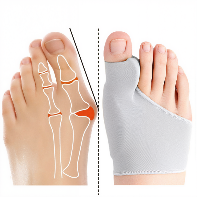 Separador de Dedos de Gel para Corrección de Juanetes y Alivio del Dolor