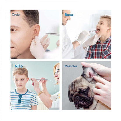 Otoscopio digital con pantalla de 4,5 pulgadas